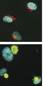 Virus factory: The top image shows uninfected, normal human cells with cell nuclei in blue and the cellular protein processing apparatus in red. In the infected cells (bottom image), the virus has produced proteins (green) that take over and reorganize the cellular processing apparatus into a virus factory. (Photo: Farah Bughio, Felicia Goodrum) Virus factory: The top image shows uninfected, normal human cells with cell nuclei in blue and the cellular protein processing apparatus in red. In the infected cells (bottom image), the virus has produced proteins (green) that take over and reorganize the cellular processing apparatus into a virus factory. (Photo: Farah Bughio, Felicia Goodrum)